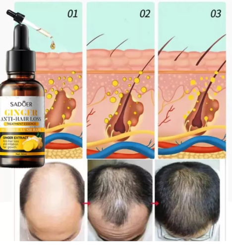 Сыворотка для роста волос и бровей с экстрактом имбиря фото 6