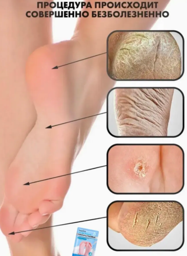 Маска для ног питательные.Козье молоко фото 6