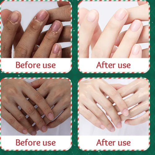 Маска для рук фото 5