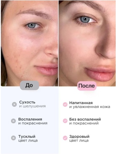 Крем для лица увлажняющий, для сияния кожи, 50 мл фото 7