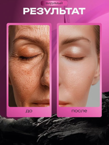 Сыворотка для лица с керамидами Dr.CELLIO 4in1 Teunteun Ampoule (Recovery) 50мл фото 5