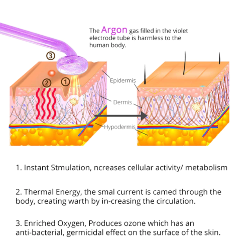Снегоуборщик с литиевой батареей фото 4