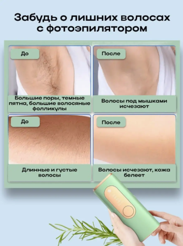 Фотоэпилятор для удаления волос зелёный Vsd-310-33  Удаление волос лазером фото 10